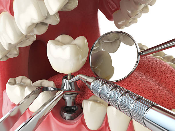 Best Emergency Treatment for Toothache in Embreeville, TN